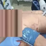 Jovem é esfaqueado durante confusão na Expovale em Vale do Paraíso