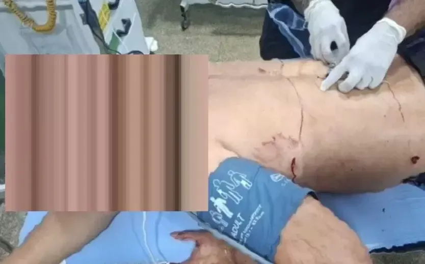 Jovem é esfaqueado durante confusão na Expovale em Vale do Paraíso