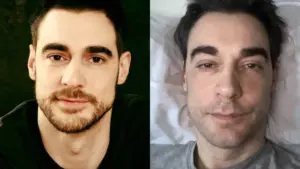 Ator francês Arnaud Denis morre aos 43 anos após eutanásia na Bélgica