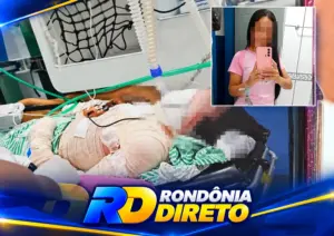 Mulher sofre queimaduras após atear fogo ao próprio corpo durante discussão em Cerejeiras