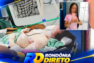 Mulher sofre queimaduras após atear fogo ao próprio corpo durante discussão em Cerejeiras