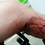 Rapaz de 25 anos é baleado em praça de Vilhena e sobrevive após ser socorrido