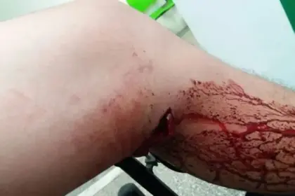 Rapaz de 25 anos é baleado em praça de Vilhena e sobrevive após ser socorrido