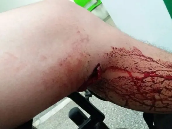 Rapaz de 25 anos é baleado em praça de Vilhena e sobrevive após ser socorrido