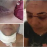 Linha de pipa deixa duas pessoas feridas em Cacoal e reacende alerta sobre uso de cerol