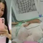 Mulher de 42 anos morre em hospital de Vilhena após sofrer queimaduras graves em Cerejeiras