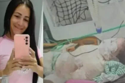 Mulher de 42 anos morre em hospital de Vilhena após sofrer queimaduras graves em Cerejeiras