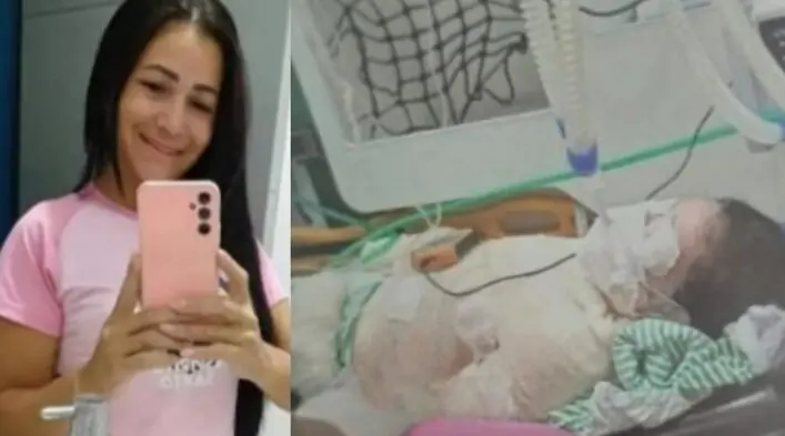 Mulher de 42 anos morre em hospital de Vilhena após sofrer queimaduras graves em Cerejeiras